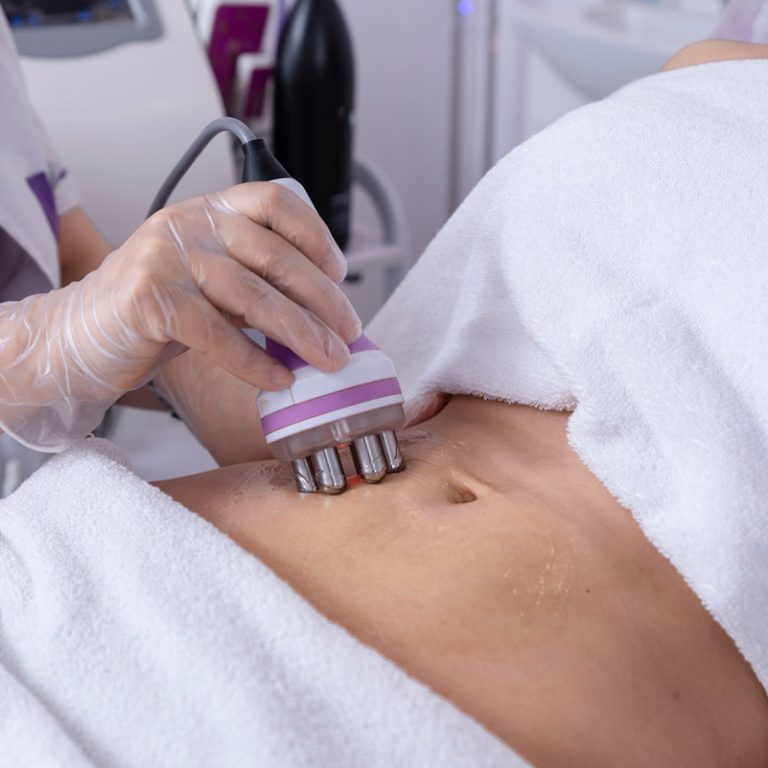 radiofrequency-body-treatment-of-abdomen-non-surg-2023-11-27-05-10-31-utc