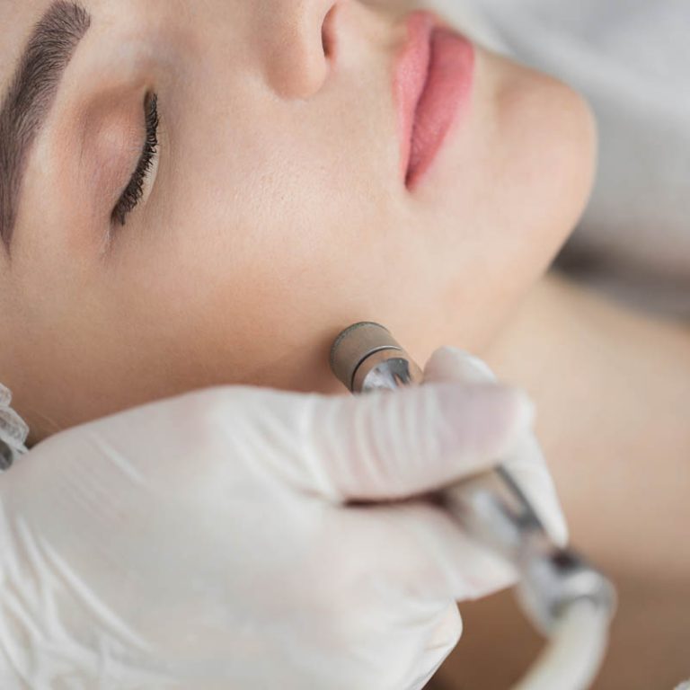Diamond microdermabrasion, peeling cosmetic. woman during a microdermabrasion treatment in beauty salon